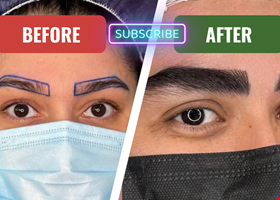 نمونه کاره نمونه کار ابرو | قبل و بعد واقعی